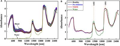 Early Diagnosis of Type 2 Diabetes Based on Near-Infrared Spectroscopy Combined With Machine Learning and Aquaphotomics